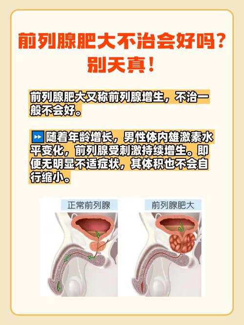 前列腺增大回声欠均匀是怎么回事