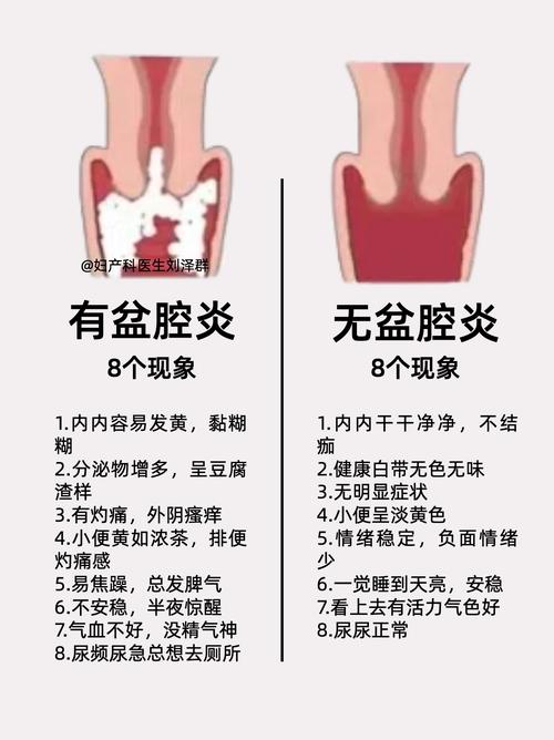 急性盆腔炎和慢性盆腔炎区别 急性盆腔炎和慢性盆腔炎区别