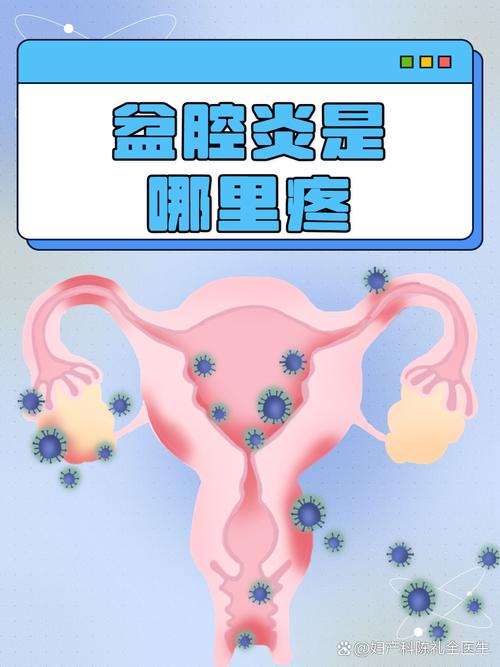 急性盆腔炎和慢性盆腔炎区别 急性盆腔炎和慢性盆腔炎区别