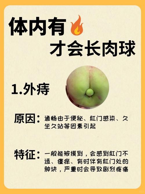 痔疮的痔核是什么