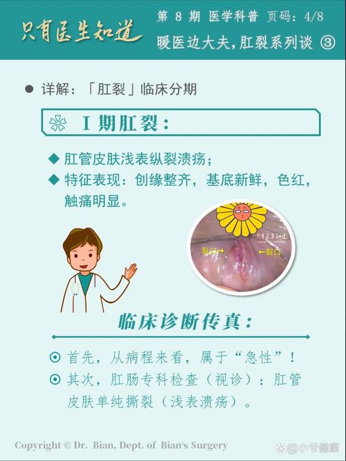 一大便肛门就裂开出血?肛裂的常见临床表现有哪些? 一大便肛门就裂开出血?肛裂的常见临床表现有哪些?