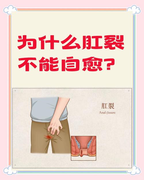 一大便肛门就裂开出血?肛裂的常见临床表现有哪些? 一大便肛门就裂开出血?肛裂的常见临床表现有哪些?