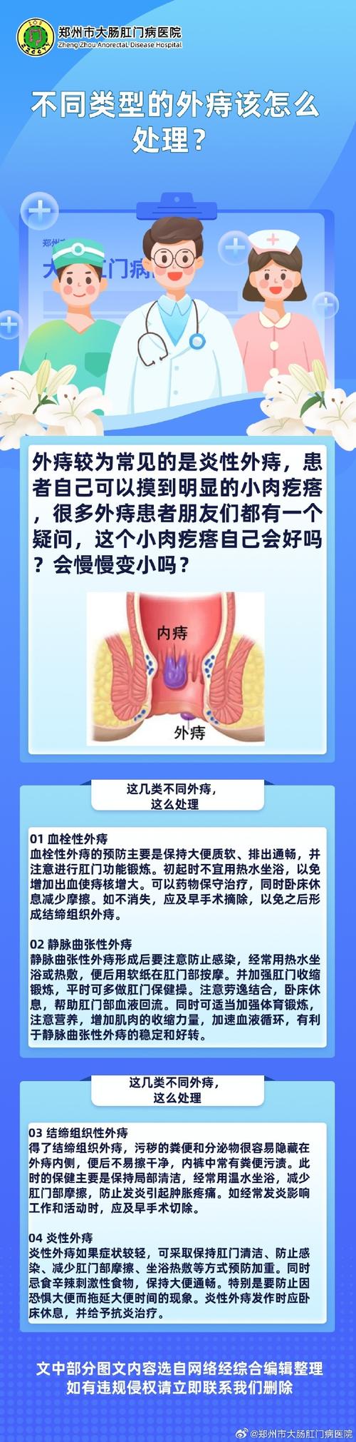 痔疮人群比例 痔疮人群比例