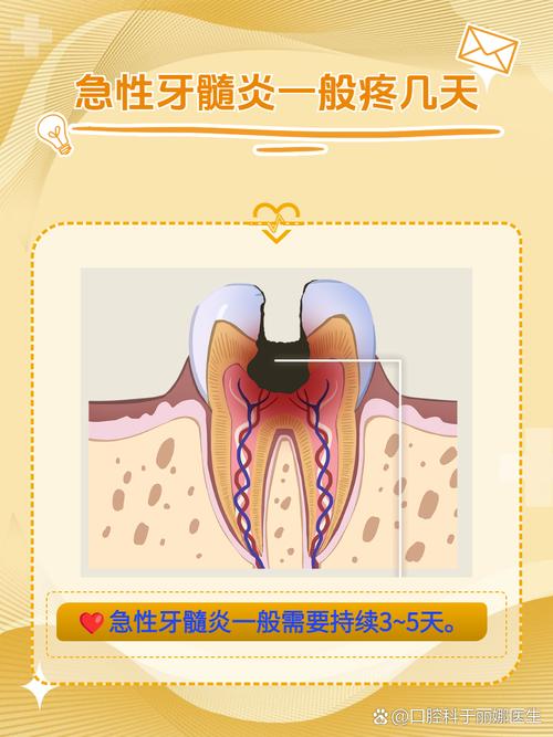 急性牙髓炎是怎么样的 急性牙髓炎是怎么样的