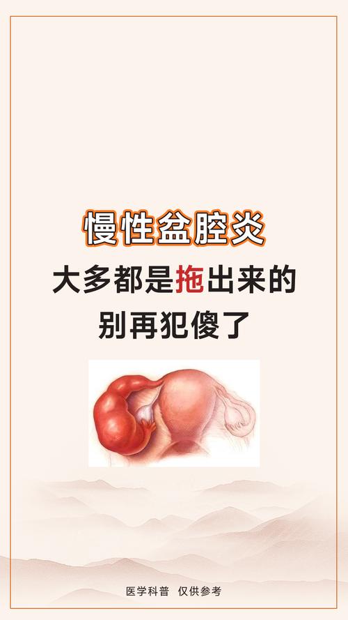 慢性盆腔炎吃什么药效果好?