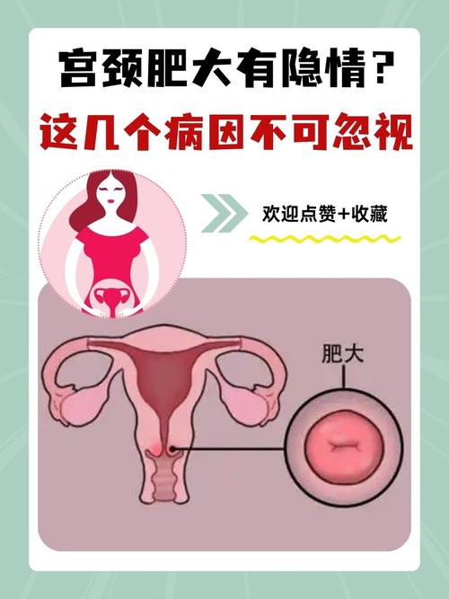 宫颈肥大是什么原因造成