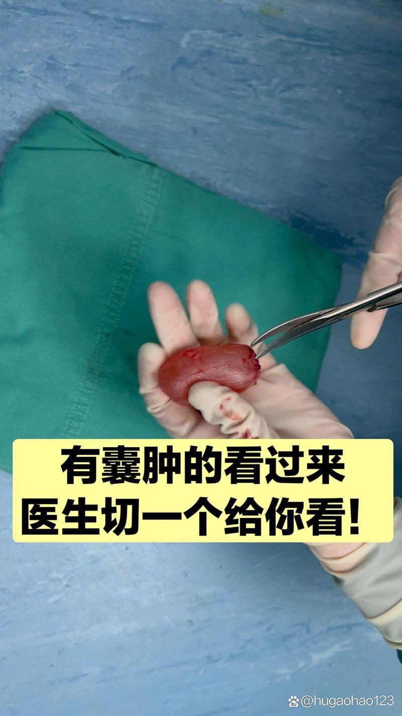 肿瘤和囊肿的区别